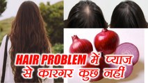 Onion for Hair problem | प्याज़ से सुलझाऐं बालों की हर समस्या | Boldsky