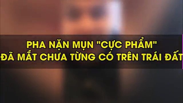 Những pha nặn mụn nhìn thôi cũng thấy đã