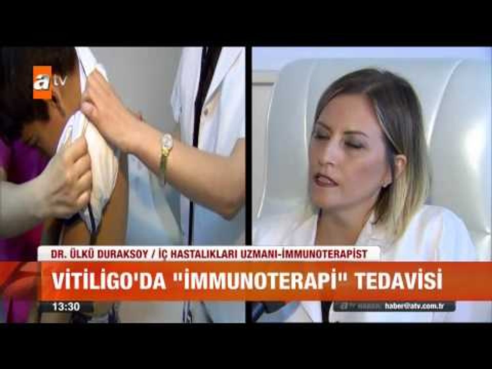 Vitiligo'da yeni tedavi yöntemi - atv Gün Ortası Bülteni