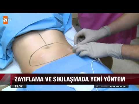 Zayıflama ve sıkılaşmada yeni yöntem - atv Ana Haber