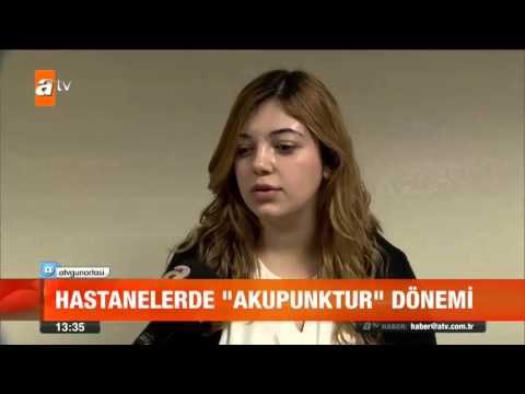 Hastanelerde akupunktur dönemi - atv Gün Ortası Bülteni