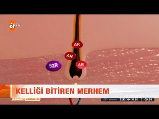 Kelliği bitiren merhem - atv Kahvaltı Haberleri