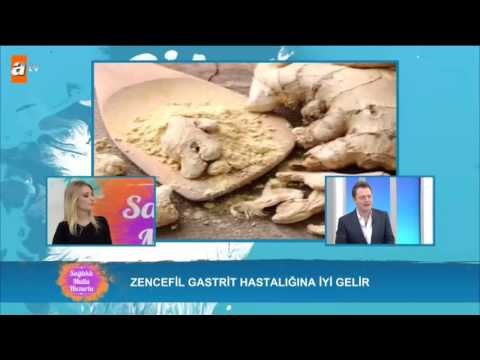 Zencefil baş ağrısına iyi gelir! - Sağlıklı Mutlu Huzurlu 70. Bölüm - atv