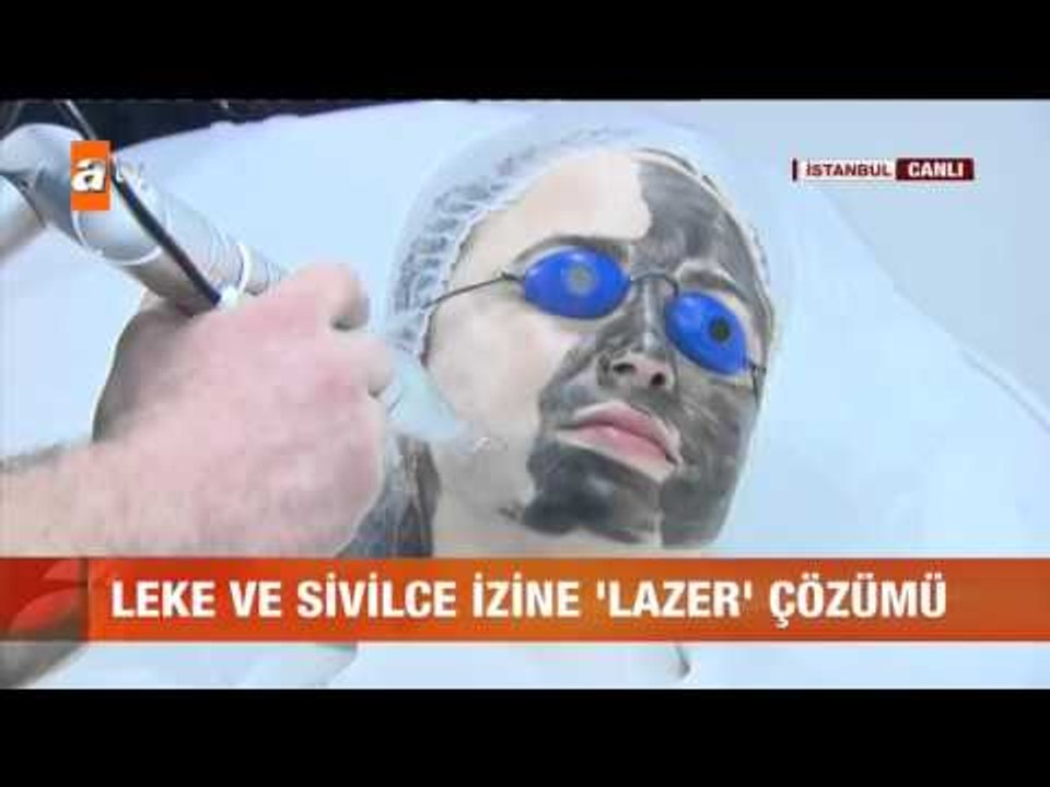 Leke ve sivilce izine lazer çözümü - atv Gün Or...