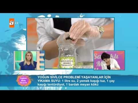 Yoğun sivilce sorunu yaşanları için yıkama suyu - Sağlıklı Mutlu Huzurlu 115. Bölüm - atv