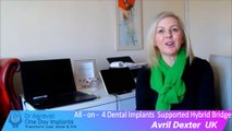 All on 4 dental implants reviews of Dr Agravat One Day Dental Implant clinic patient from UK