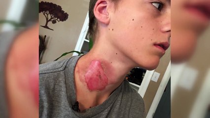 Pendant qu'il dormait, ses amis lui ont fait une blague qui aurait pu tourner au drame...