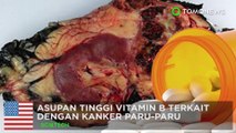 Vitamin B berlebih dapat menyebabkan kanker paru-paruitamin B berlebih dapat menyebabkan kanker paru-paru - TomoNews