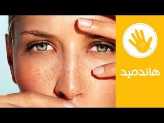 طريقة فعالة لعلاج انتفاخ العينين | وصفة طبيعية لعلاج انتفاخ العينين | هاندميد