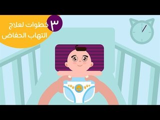 3 خطوات لعلاج التهاب الحفاض |How to treat diaper rash | العناية بالبيبي