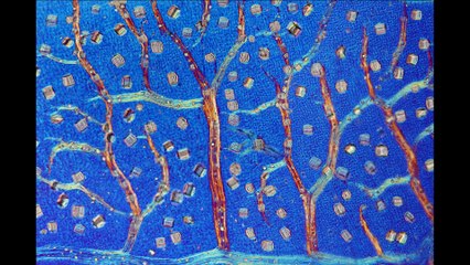 Micro Photo : Comme l'arbre qui cache la forêt...