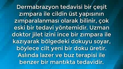 Jilet İzi Nasıl Geçer