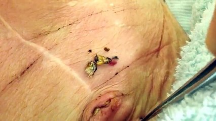 Ventre bouton peluche nombril de sésame énorme