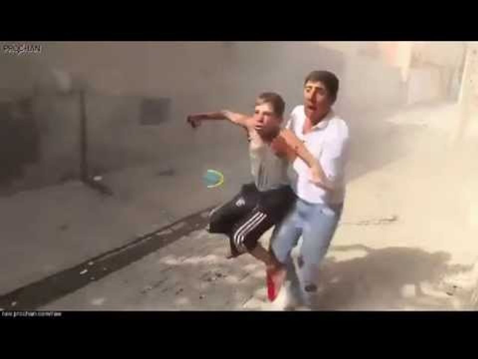 قنبلة تقطع يد طفل سوري على المباشر