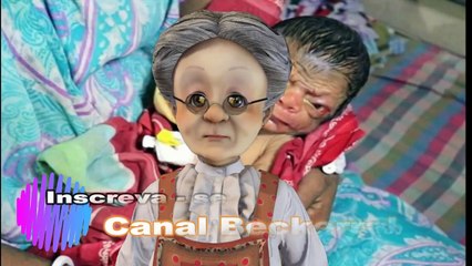 Bebê nasce com aparência de idoso de 80 anos