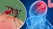 Virus Zika dapat digunakan untuk pengobatan kanker otak - TomoNews