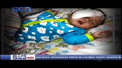 Anak Kedua Asri Welas Jalani Operasi Katarak
