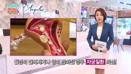 가임기 여성에게 흔한 자궁질환, 하이푸 시술 알아보기 / YTN
