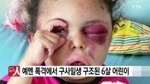 [영상] '고사리 손'으로 폭격에 멍든 눈을...예멘 참상 알려 / YTN