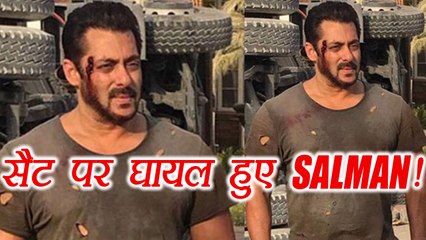 Salman Khan INJURED on the sets of Tiger Zinda Hai; Watch | FilmiBeat