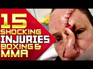 15 Most Shocking Injuries In Boxing/MMA