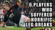 6 Players Who Suffered Horrific Leg Breaks