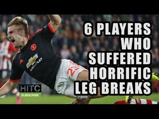 6 Players Who Suffered Horrific Leg Breaks