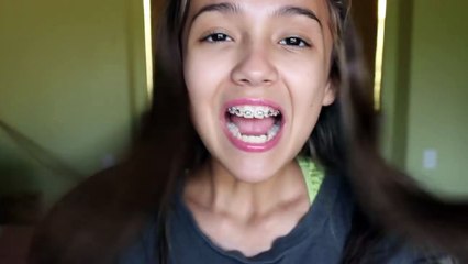 Braces 101: Getting Them On