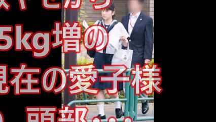 【皇室】激ヤセから15kg増の現在の愛子様の、頭部・・・