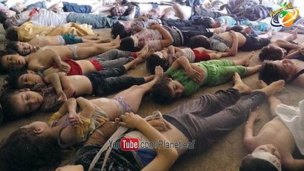 Top 10 Most Dangerous Diseases Which Killed Millions of People _ జనాల ప్రాణాలు తీస్తున్న10 రోగాలు