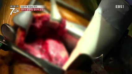 메디컬 다큐 7요일 - 고통없는 세상을 꿈꾸며- 복합부위 통증 증후군 외_#001