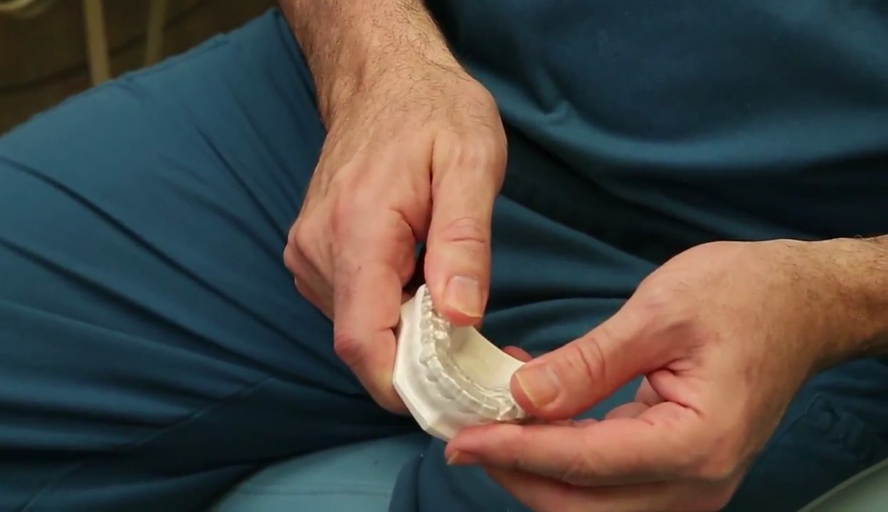 Grinding Teeth During Sleep - Doylestown, PA - Dr. Wilderman