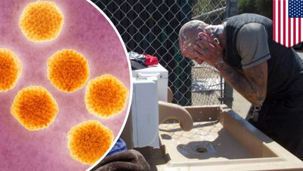San Diego streets power washed to fight Hepatitis A outbreak