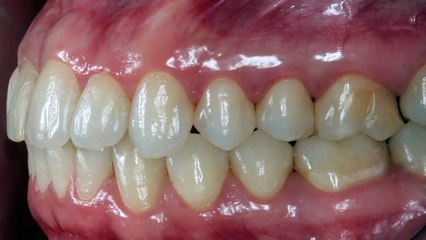 Digital Dental Photography, 7 Standard images for IntraOral Set-up