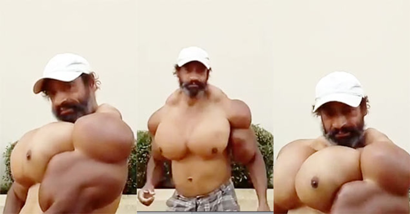 Oil Injected "Bodybuilder" Is The Stuff Of Nightmares