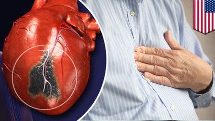 What are the symptoms of a silent heart attack?