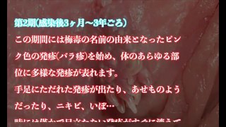 【本当は怖い】梅毒に感染してしまうと…。　怖すぎる症状と対処法まとめ