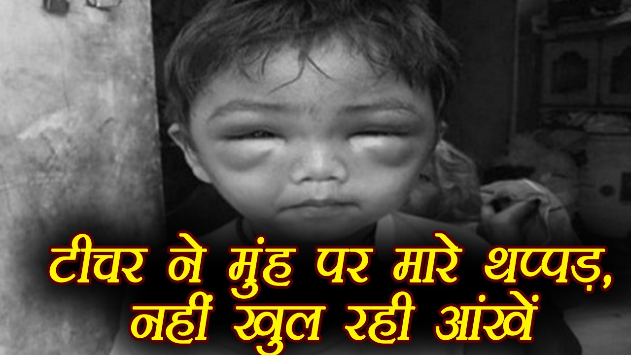 Maharashtra: Tuition teacher mercilessly beats up 3-year-old boy | वनइंडिया हिंदी