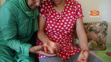 Fatna, 16 ans, violemment agressée pour avoir refusé une demande en mariage