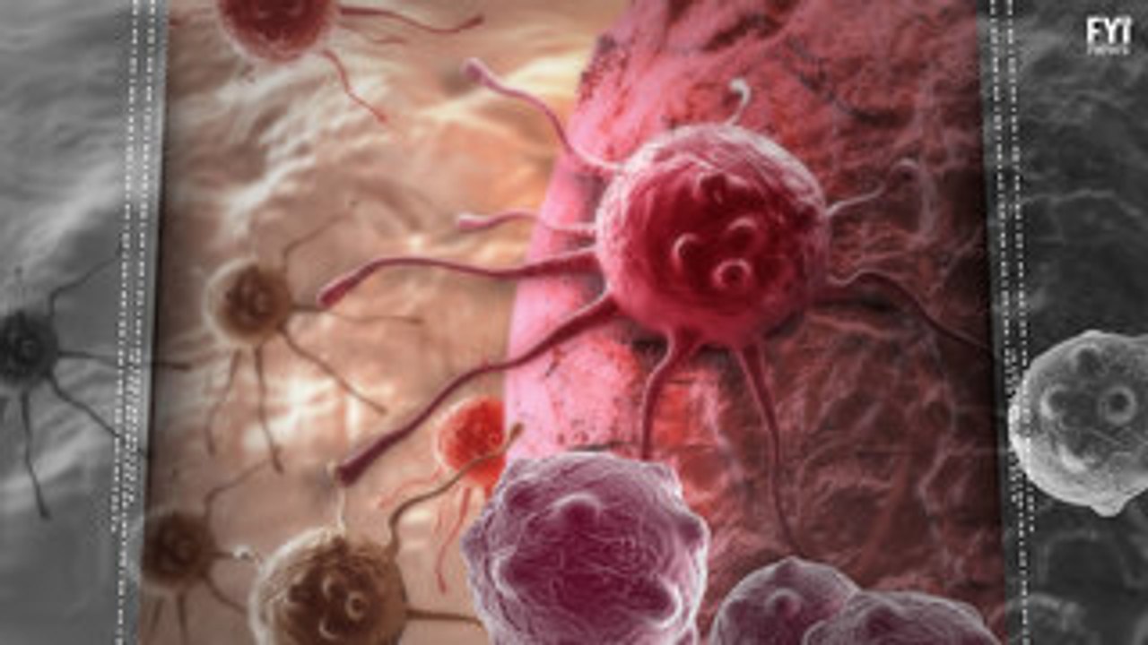 The Dangers of Alternative Cancer Treatments