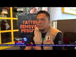 Program Hapus Tato Gratis Di Bandung - NET5