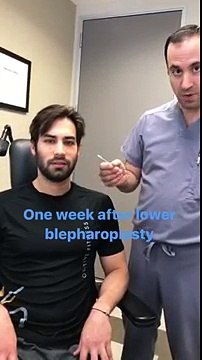 Excellent Cosmetic Eyelid Surgery - Blepharoplasty