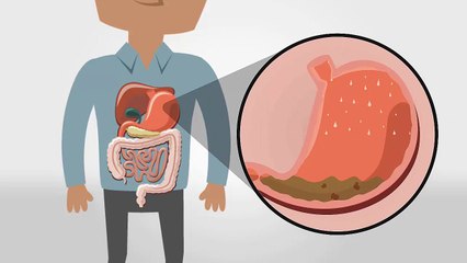 Pillars of GI Health Graphic Animation Video - Chen Ben-Asher