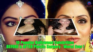 10 Popular Bollywood Celebrities BEFORE & AFTER Plastic Surgery   Worst Ever !
