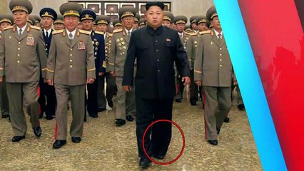Experts Believe Kim Jong Un Has Humiliating Disease For His Age