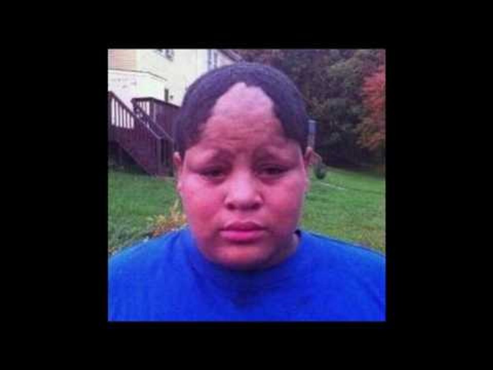 Funny Hairline Fails - Try not to laugh 2017 Compilation