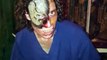 Our dentist going barking mad! - Spookers Haunted Attraction Scream Park, New Zealand
