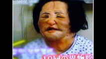 PLASTIC SURGERY GONE WRONG
