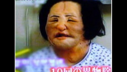PLASTIC SURGERY GONE WRONG