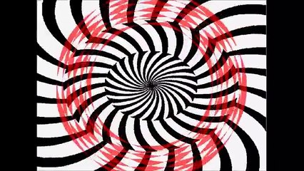 lazy eyes treatment and exercises (Amblyopia) 弱視治療及訓練